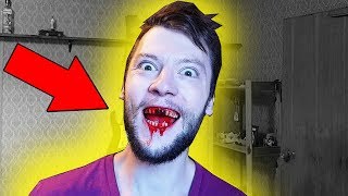 Я ВЫБИЛ ЗУБЫ И ЭТО НЕ ПРАНК / УМЕР ОТ ПОТЕРИ КРОВИ Я ВЫБИЛ ЗУБЫ И ЭТО НЕ ПРАНК / УМЕР ОТ ПОТЕРИ КРОВИ