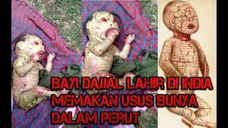 Bayi Dajjal LAhir Di India Memakan Usus Ibunya Sampai Meninggal