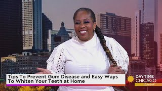 Tips To Prevent Gum Disease and Easy Ways To Whiten Your Teeth at Home
