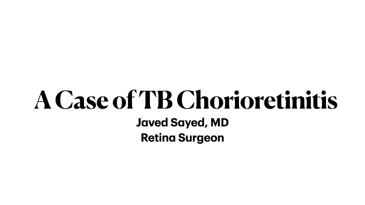 TB Chorioretinitis