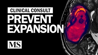 Clinical Consult: Prevent Expansion by The Neurophile (by Rutgers RWJMS Neurology) 9,211 views 3 years ago 22 minutes