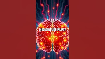 The Groundbreaking Discovery of the EEG