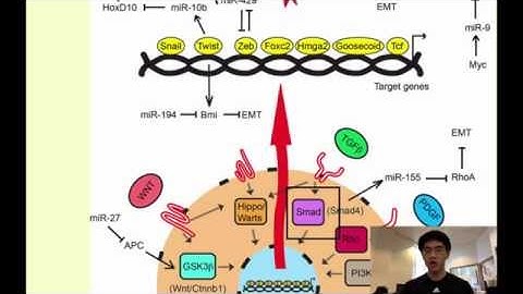 A Novel Form of Cancer Therapy: Targeting Metastatic EMT