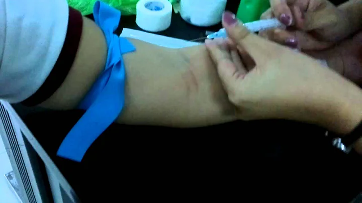 VENIPUNCTURE :) Eunice Atienza
