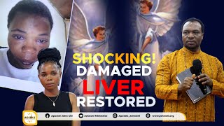 SHOCKING! DAMAGED LIVER RESTORED
