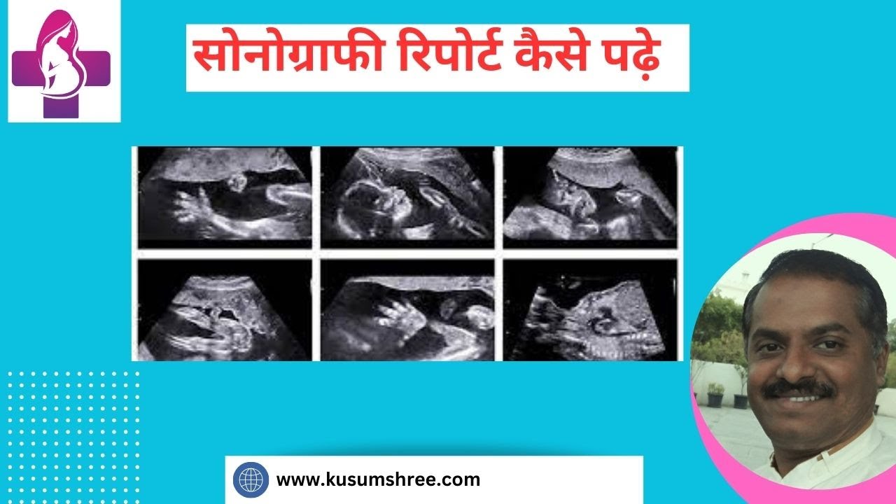 How To Read Sonography Report Of Pregnancy At Home How To Read Sonography Report Of Pregnancy At Home