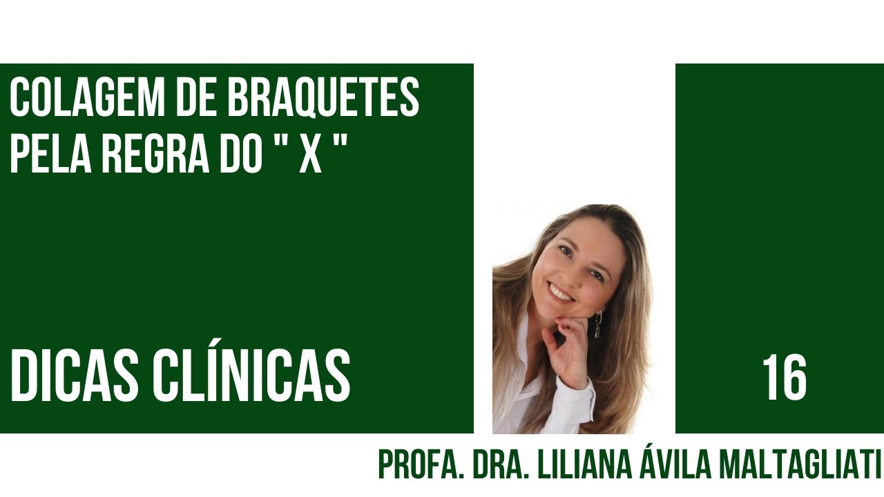 Colagem de Braquetes pela regra do " X "