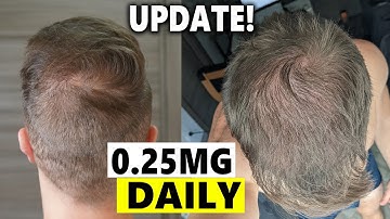 Finasteride Microdosing Update 2022!