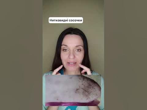 Прищі на язику, в чому причина, що робити? - YouTube