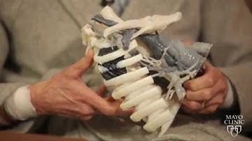 3D Printing of Patients