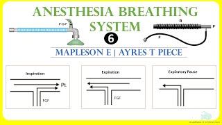 Mapleson E  | Ayres T-piece | Anesthesia breathing system6