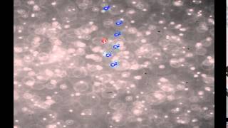 particle tracking
