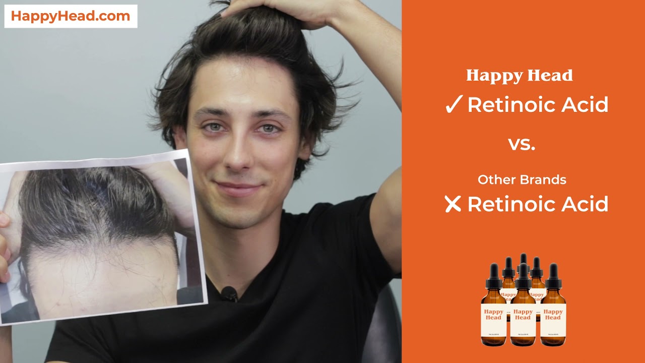 Happy Head Topical Hair Loss Solution YouTube