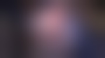 Correction Butt Frame in the Hexapod Circular Fixator   Dr  Ayman Nashashibi   د  أيمن النشاشيبي