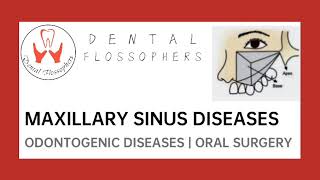 MAXILLARY SINUS DISEASES | SINUSITIS | ORO-ANTRAL COMMUNICATION/FISTULA | CALDWELL-LUC PROCEDURE