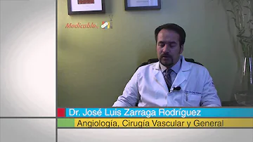 ¿Qué no se debe hacer antes de la escleroterapia?