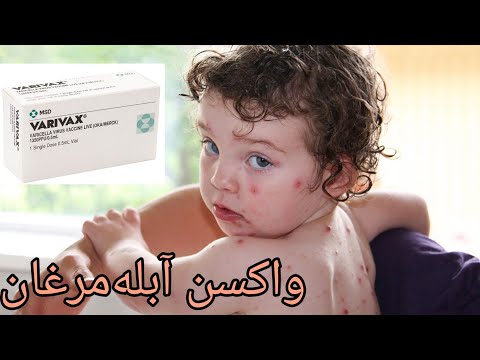 واکسن آبله مرغان هرچی باید بدونید سن تزریق دوزها عوارض و موارد منع مصرف
