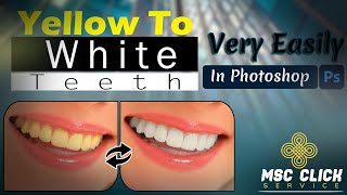 How To Do Yellow To White Teeth In Adobe Photoshop