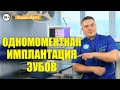 Одномоментная имплантация зубов: Как вставить зуб за 1 день? (Видео) Люми-Дент Киев.