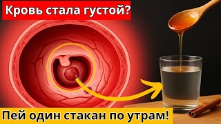 Опасаетесь тромбов? Утренний напиток и 3 ошибки, из-за которых кровь становится густой!