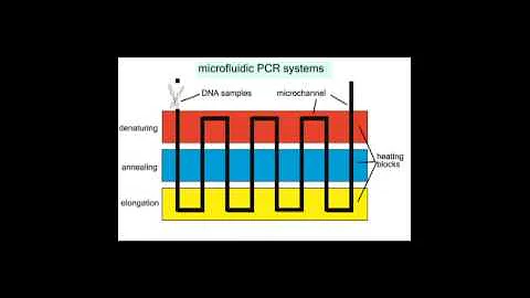 Stars in Global Health: Rapid, low-cost pulmonary TB test