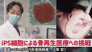 iPS細胞による骨再生医療への挑戦【異能vation2019年度挑戦者・江草 宏】