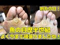 長年のウオノメとお別れした日