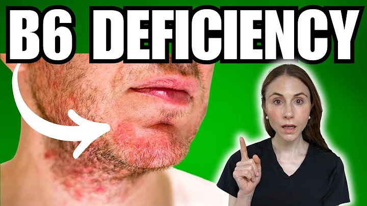 5 Warning Signs Of Vitamin B6 Deficiency NOT TO MISS