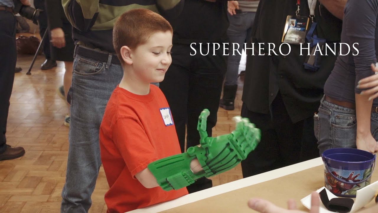 Rice bioengineers use 3-D printers to give kids a hand