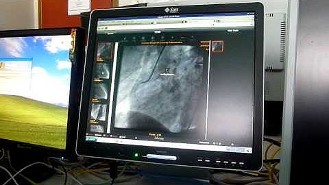 Oracle VDI on Sun Ray - Demo Video Coronary Catherization