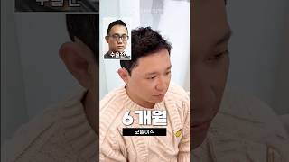 모발이식 6개월 후기 #shorts