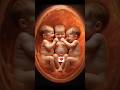 Triplet Babies In Womb 5D Ultrasound Fetal Movement Smiling Playing Pregnancy Shorts Baby 