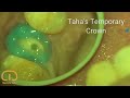Taha Temporary Crown Technique Dr Mostafa Taha Taha Temporary Crown Technique Dr Mostafa Taha