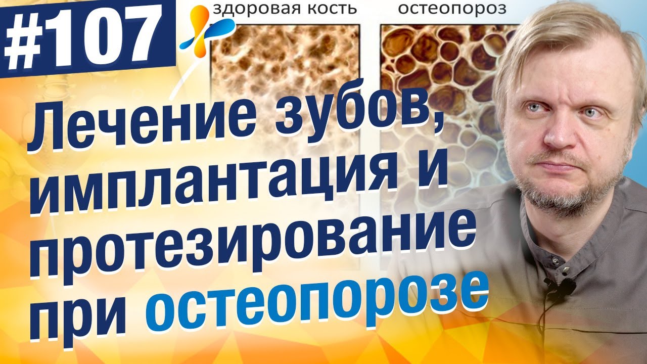 Лечение, протезирование и имплантация зубов при остеопорозе. Что важно знать?
