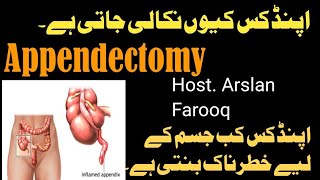 Appendectomy| Removal Of Appendix. Cause Vomiting. High Fever. Abdominal Pain.#pain