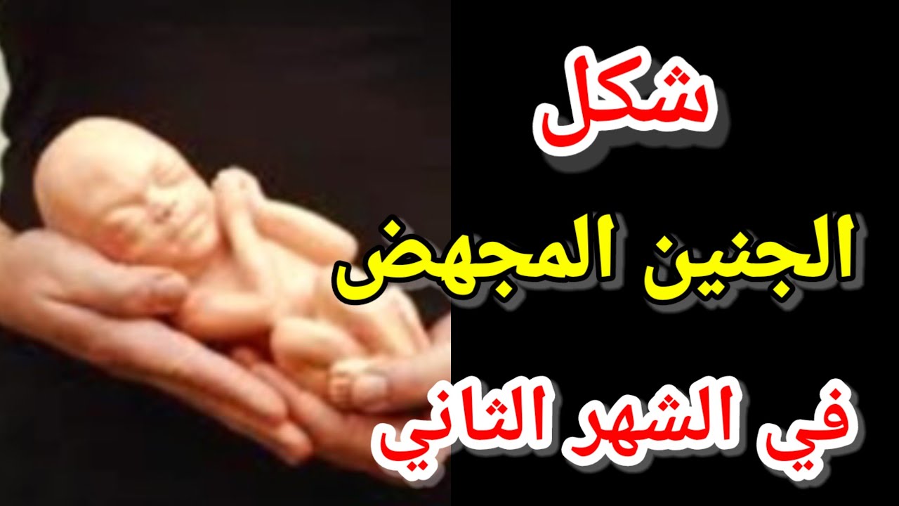 شكل الجنين المجهض في الشهر الثاني بالصور|شكل الجنين في الشهر الثاني بالصور|جنين في الشهر الثاني