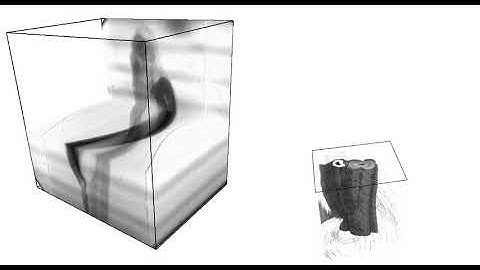 Video 1. X-ray Projection and Sinogram.