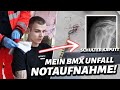 Mein BMX UNFALL! ICH muss in die NOTAUFNAHME 😱🚑 ( Schulter gebrochen?)