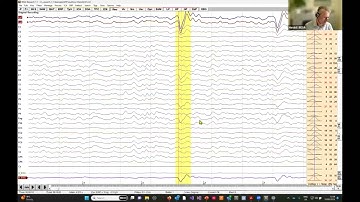 BESA Research Workshop Tutorial 2A: Basic Artifact Correction