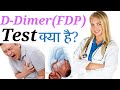 Lecture-#15D-Dimer(FDP)Test/Introduction, procedure, Result in hindi