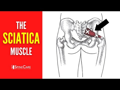 The Sciatica Muscle (How to Release It for INSTANT RELIEF)