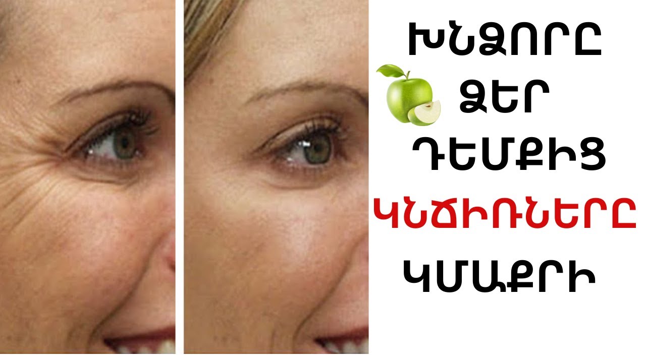 Ի՞նչ կլինի եթե շաբաթը 2 անգամ այս  դիմակ քսեք ձեր դեմքին