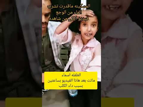 عضه كلب الطفله اسماء ماتت بعدهاذا الفيديو بساعتين بسبب داء الكلب الفيديو كامل