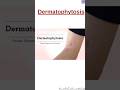 Dermatophytosis|CPC Exam|Shorts| Medical Coding and Billing|@medicalcodercertified