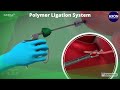 Grena polymer ligation system  grena polymerligationclips axonmedicalsolutions