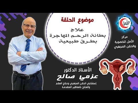علاج بطانة الرحم المهاجرة بطرق طبيعية دكتور عزمي صالح مركز الامل للخصوبة