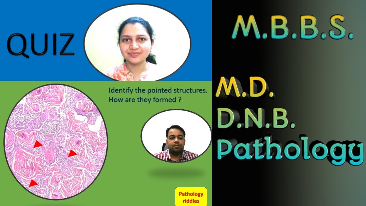 Quiz for Undergraduate Pathology Students MBBS and MD, DNB Students ...