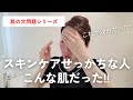 【意外な理由】ポロポロ肌はスキンケアのやり方に問題があった！