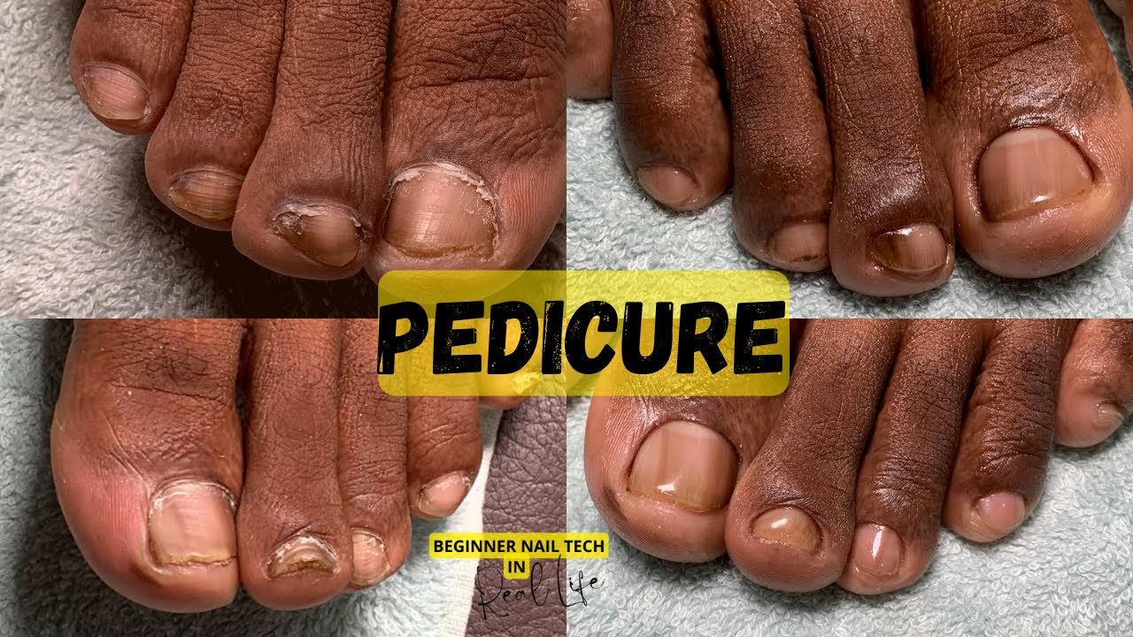 Full Male Pedicure Transformation Both Feet