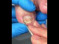 Satisfying Toenail Grooming | Gentle Foot Care Routine #fypシ #cleannails #RelaxingCare #fypシ
